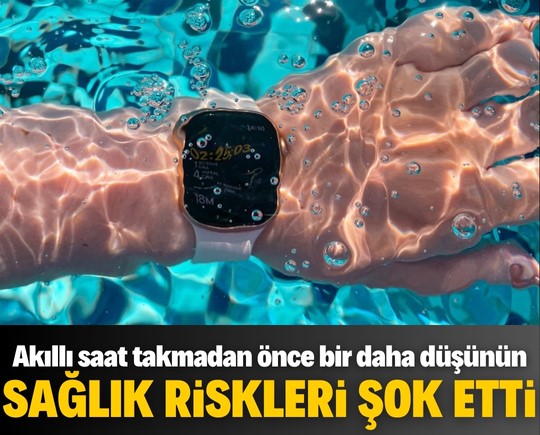 Akıllı saat takmadan önce bir daha düşünün: Sağlık riskleri şok ediyor!