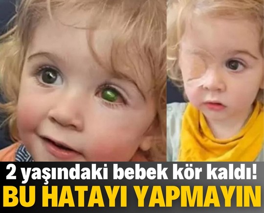 Bu hatayı yapmayın! 2 yaşındaki bebek kör kaldı!